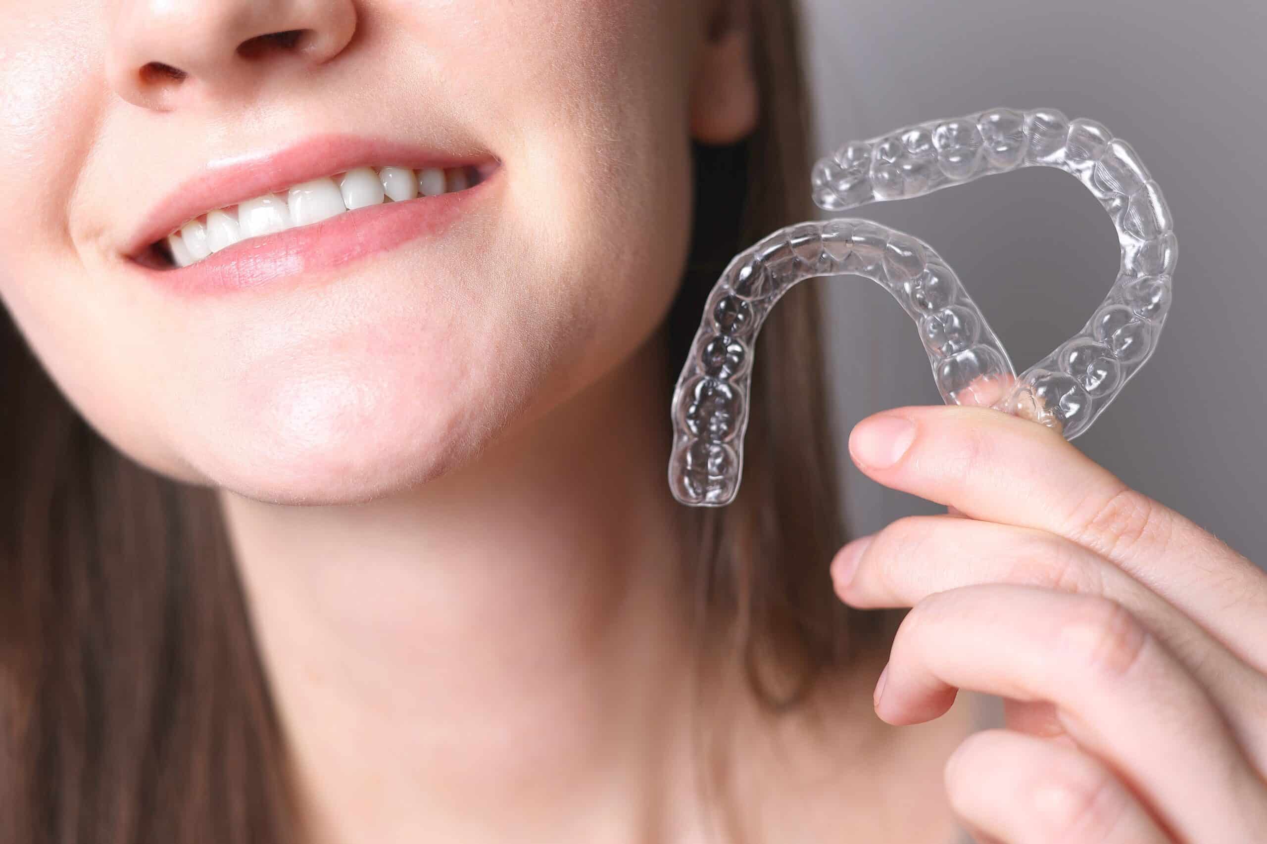 Aligners,For,Straightening,Teeth,In,A,Woman's,Hand