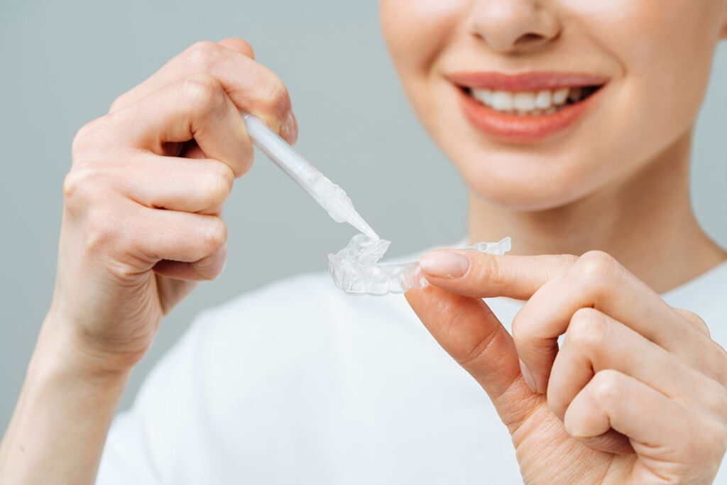 Clear Aligners Invisalign