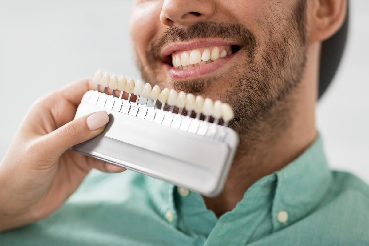 Eversmiles Dental | Porcelain Veneers in Pasadena, TX: Transforming Smiles with Strength and Beauty