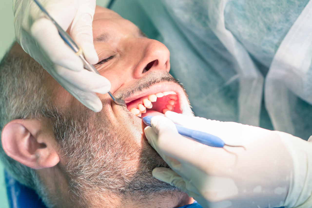 Eversmiles Dental | Dental Bridges vs. Partial Dentures: Which Tooth Replacement Option Is Right for You in Pasadena, TX?